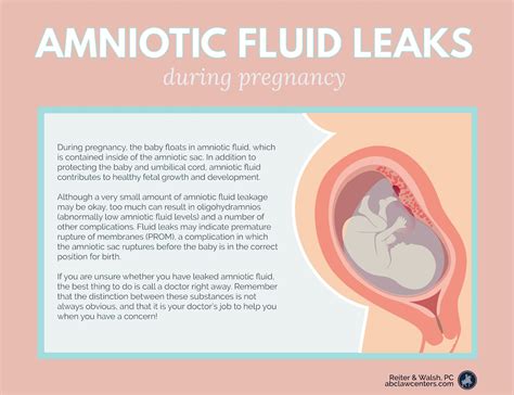 how do you know your leaking amniotic fluid|Leaking amniotic fluid: Signs and what to do